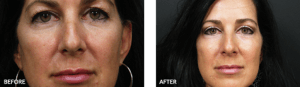thumbs_NR-Before-After-Cosmetic